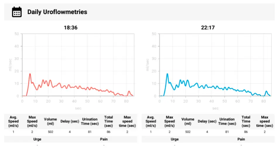 Uroflujonometría FlowSelfie: Gráfico de velocidad de flujo (ml/s). Qmax, volumen total, duración — comparado con la norma.
